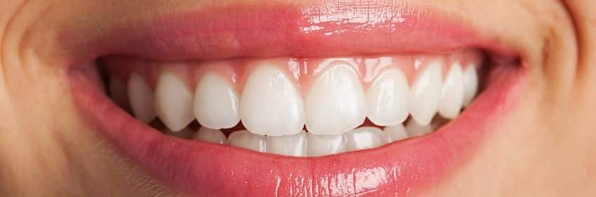 Teeth Whitening Tarneit, Point Cook, Hoppers Crossing - Tarneit Rd Dental